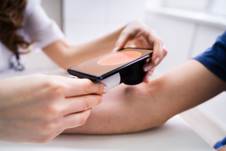 Que valent les applications sur smartphone en dermatologie?