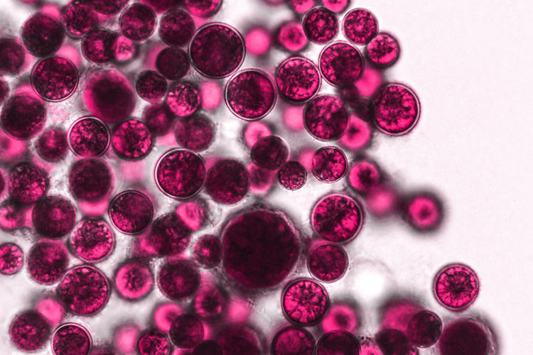 Overleving van probiotica in het gastro-intestinaal stelsel