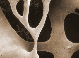 Symposium van de Belgian Bone Club: wie behandelen voor osteoporose?