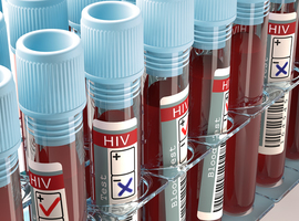 Hiv-infectie: de epidemiologie verandert, maar ook  de therapeutische mogelijkheden