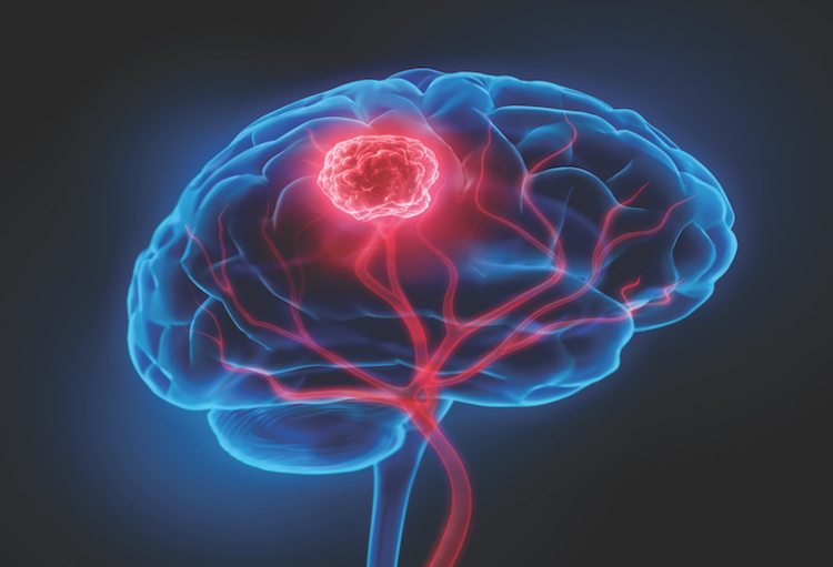 Congrès de l'ASCO 2021