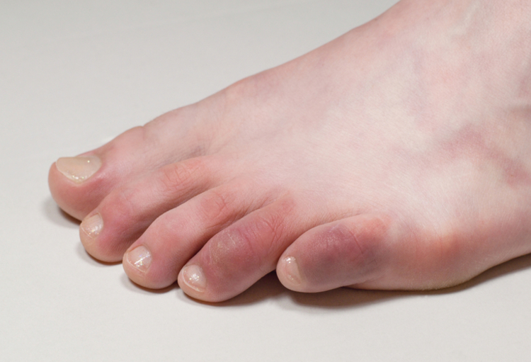 Journées Dermatologiques de Paris 2020: une session «Hot Topics» au cœur de l’actualité