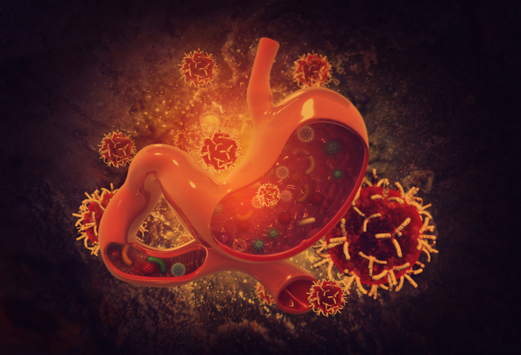 ESMO – World Congress on Gastrointestinal Cancer