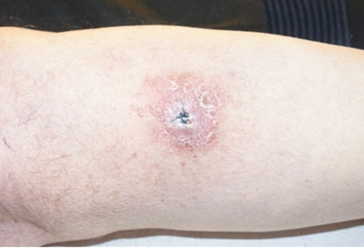 Belgian Dermatology Days 2024