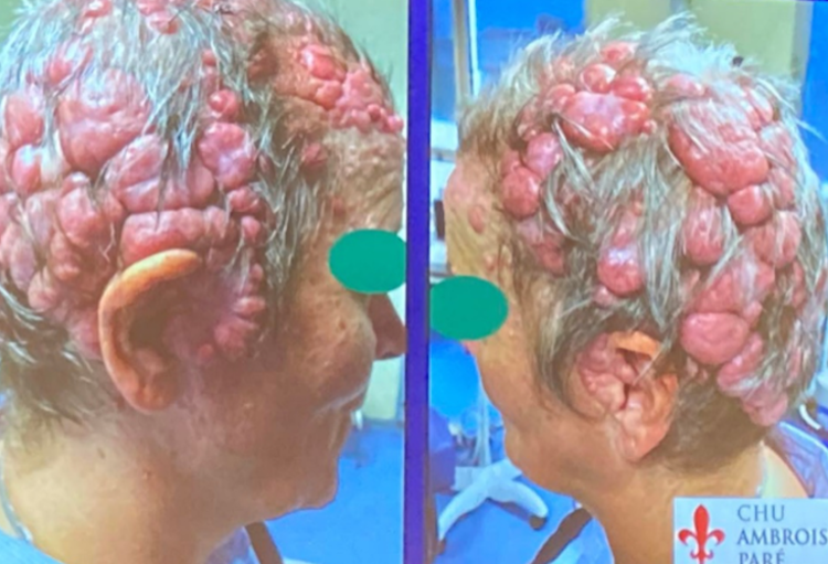 BDD: des perles, des thèses, des recherches