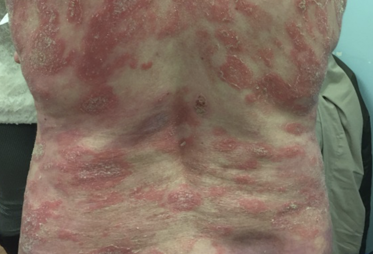 Belgian Association of Dermato-Oncology