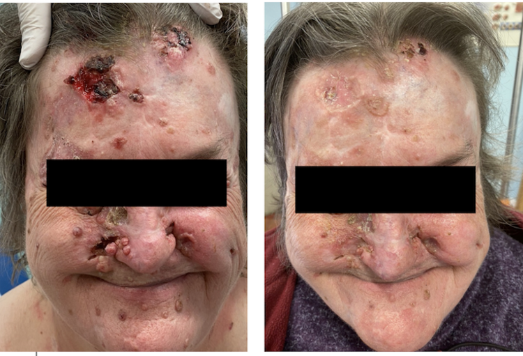 Belgian Association of Dermato-Oncology