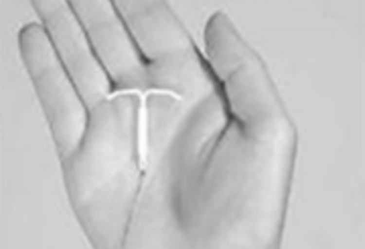 Premières autorisations de mise sur le marché pour le Levosert Medi