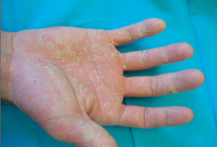 'Discoveries in Dermatology': een uittreksel