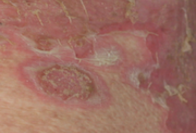 Editie 2012 van de ‘Journées dermatologiques de Paris’