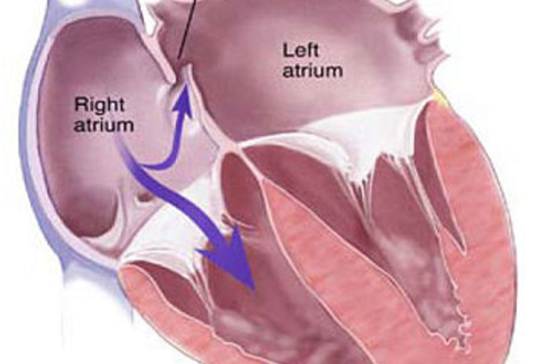 American Heart Association scientific sessions 2012