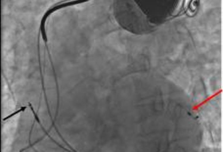 32e congres van de Belgian Society of Cardiology