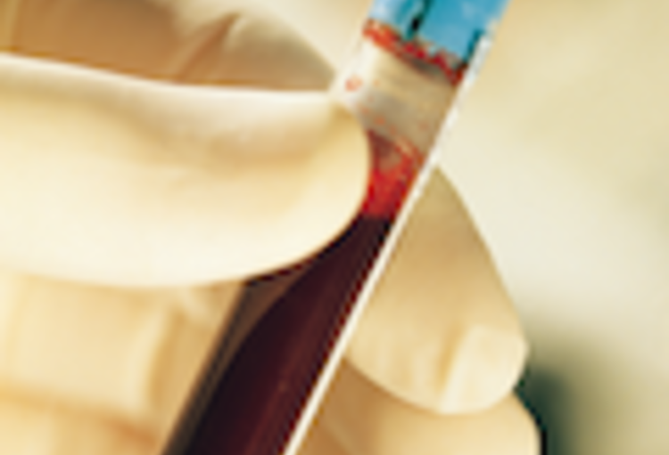 Statut mutationnel EGFR des cancers du poumon non à petites cellules