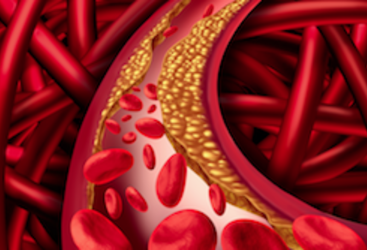 Congrès annuel de l’EASD