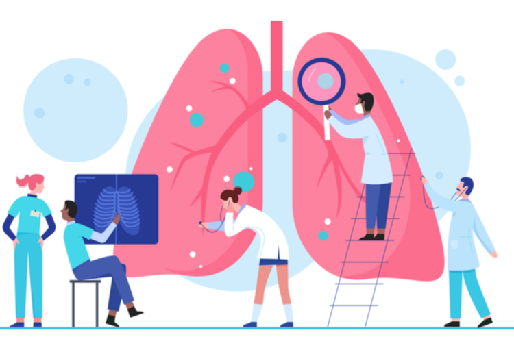 Congrès de Pneumologie de Langue Française 2022