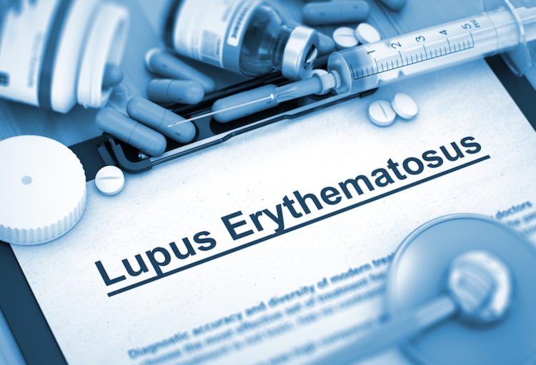 de l’EULAR concernant le lupus érythémateux systémique