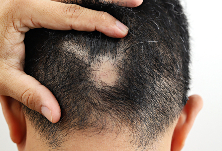 BDD: des perles, des thèses, des recherches