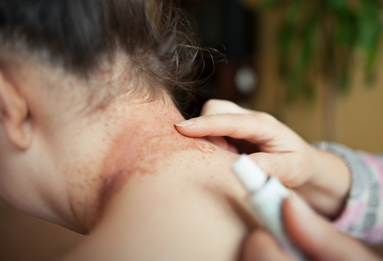 Journées Dermatologiques de Paris 2023