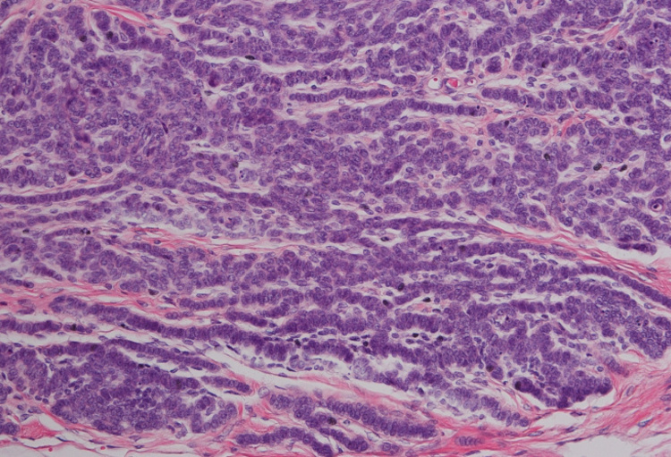 Belgian Association of Dermato-Oncology