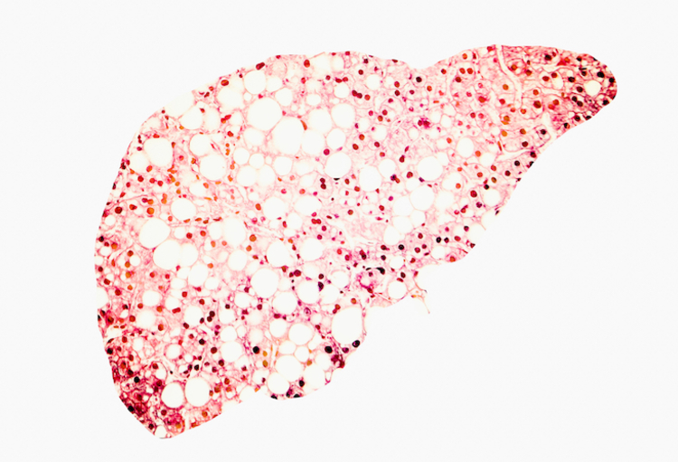 Meeting ISTH SSC 2018