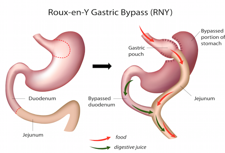 35ste Congres van de SFE