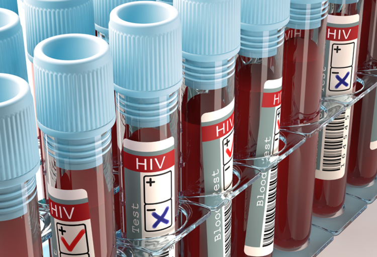 Hiv-infectie: de epidemiologie verandert, maar ook  de therapeutische mogelijkheden