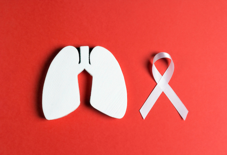 ASCO 2022: Tumeurs cérébrales: on avance… À petits pas, mais on avance!