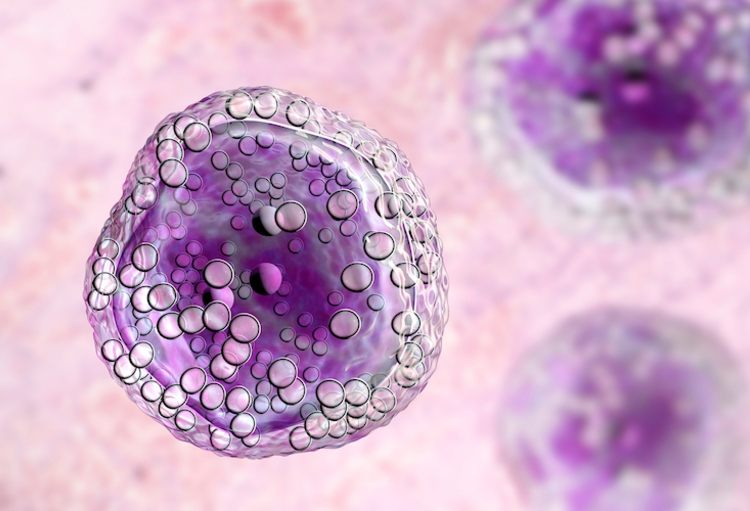 Le tisagenlecleucel dans le lymphome B diffus à grandes cellules de l’adulte OncoHemato Le tisagenlecleucel dans le lymphome B diffus à grandes cellules de l’adulte OncoHemato