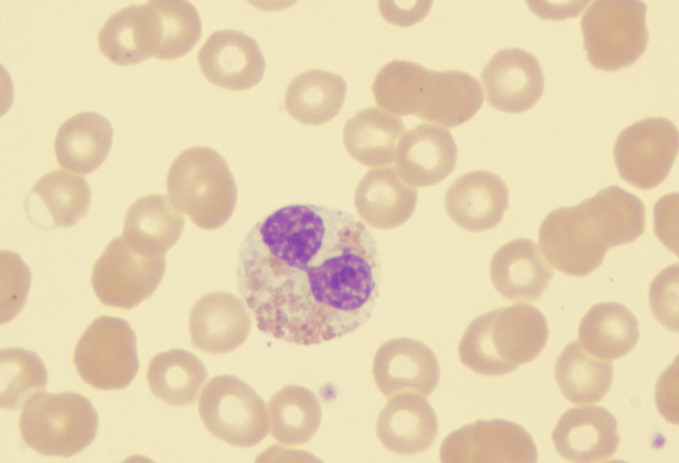 Nieuws van het ASH-congres 2018