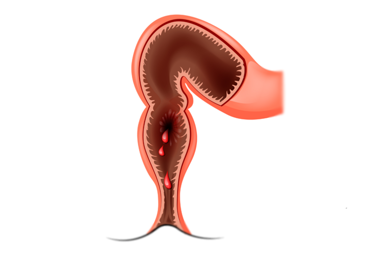 World Congress of Gastrointestinal Cancer 2019