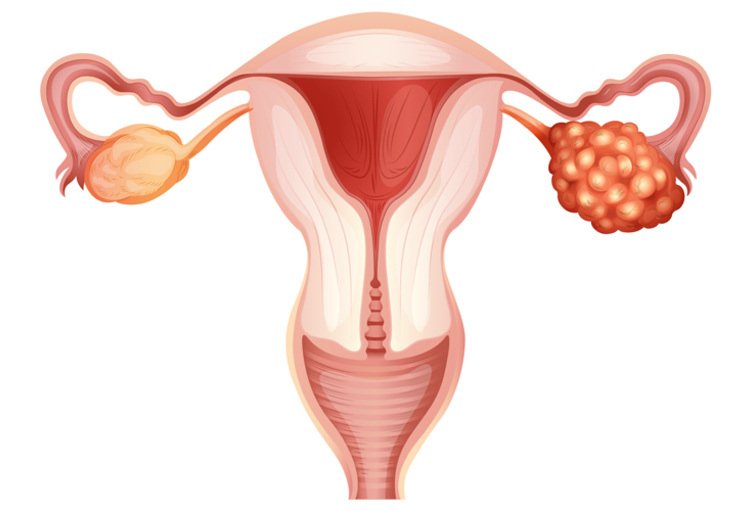 Congrès (virtuel) de l'ASCO 2020