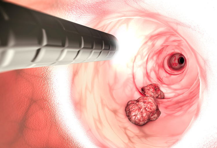 Congrès de l'ASCO 2022