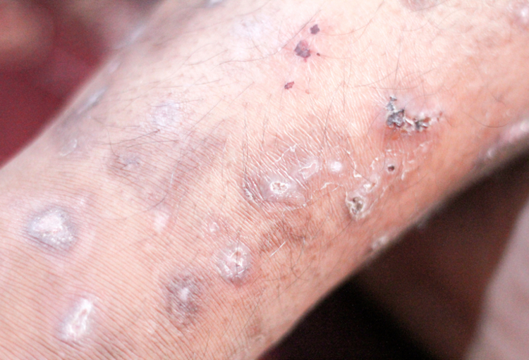 Journées Dermatologiques de Paris 2023
