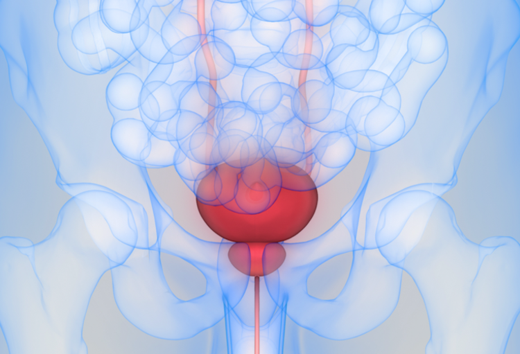 ASCO GU 2023: entre actualisation et progrès