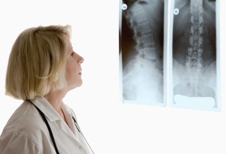 Eular 2021 - Axiale spondyloartritis: van symptomen naar behandeling