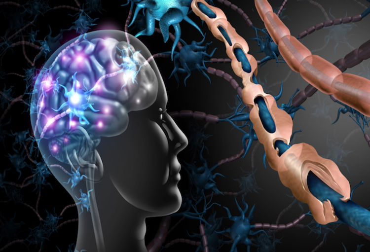 ECTRIMS 2022: Late Breaking Abstracts die onze kennis over multiple sclerose verrijken