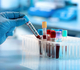 Peut-on encore prescrire n'importe quel examen de laboratoire?